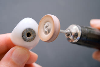 <p>An ocularist polishing an ocular prosthesis (glass eye). </p>