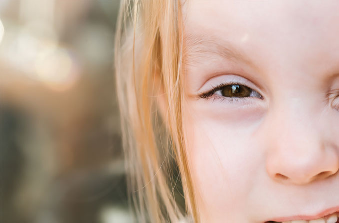 Girl squinting from light sensitivity