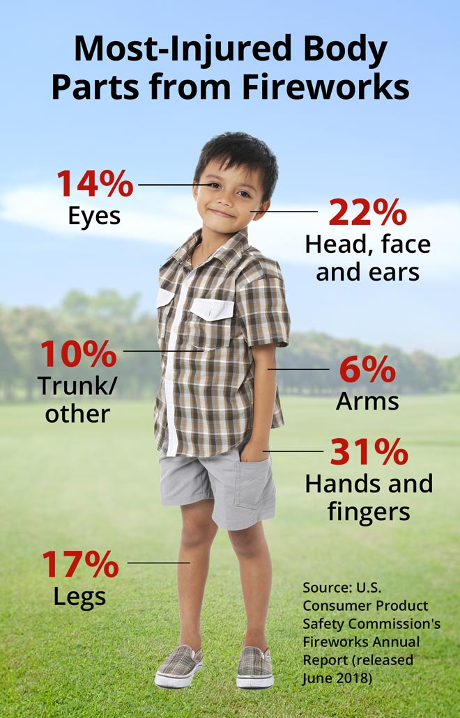 Most Injured Body Parts from Fireworks