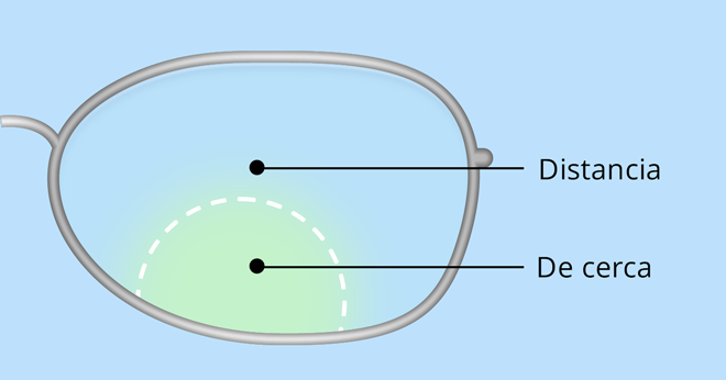 Lente bifocal integrado.