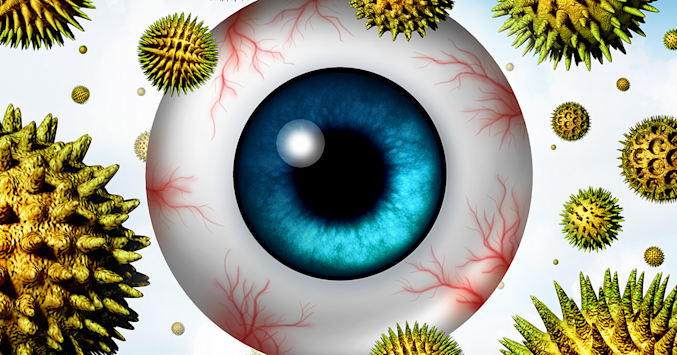 Itchy eye
