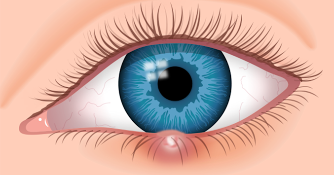 stye illustration