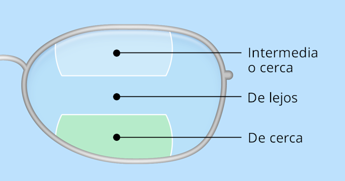 Ilustración de lentes bifocales y trifocales.