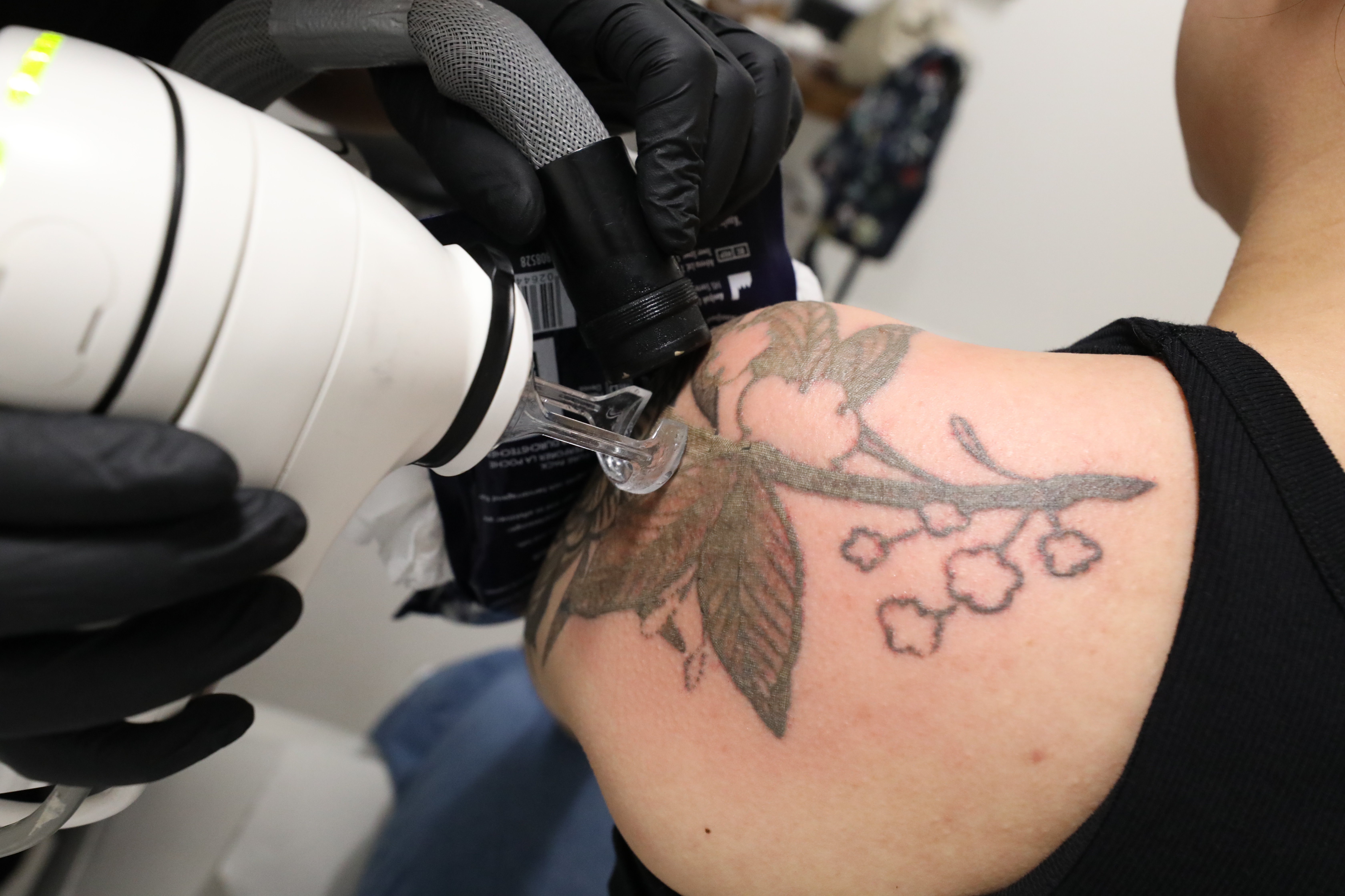 Megumi Removes a Sleeve Tattoo with a Pico Laser.