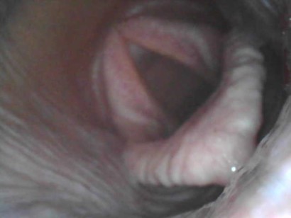 A normal larynx of a horse viewed through endoscope examination.