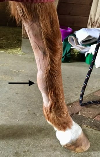 A bowed tendon on the front leg of horse, called tendinitis of the superficial digital flexor tendon.