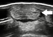 Ultrasound of the back of a horse's pastern showing tendinitis of the deep digital flexor tendon. 