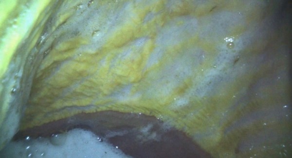 gastroscopy of horses stomach showing long term irritation