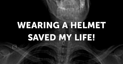Wearing a helmet saved my life!