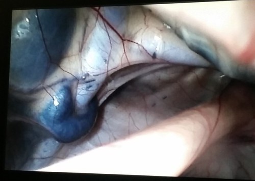 endoscopic view of smooth dark melanomas in a horses guttural pouch 