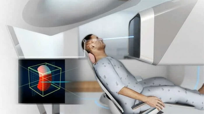 Proton beam therapy