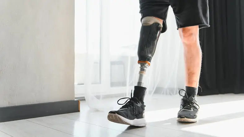 Prosthetic leg
