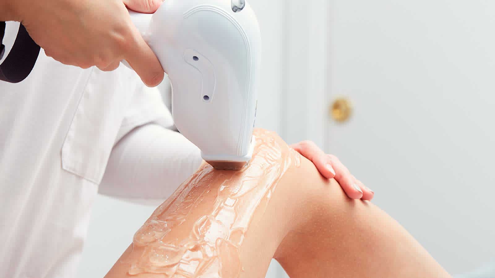 Épilation laser | Venus Épilation laser | Venus