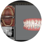 ClinCheck Pro 6 > Elevated experience > Split > #3 > Image