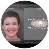 Invisalign Clincheck Pro