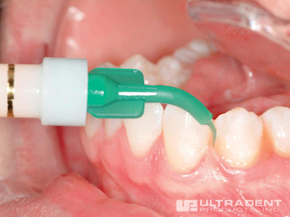 Ultracare