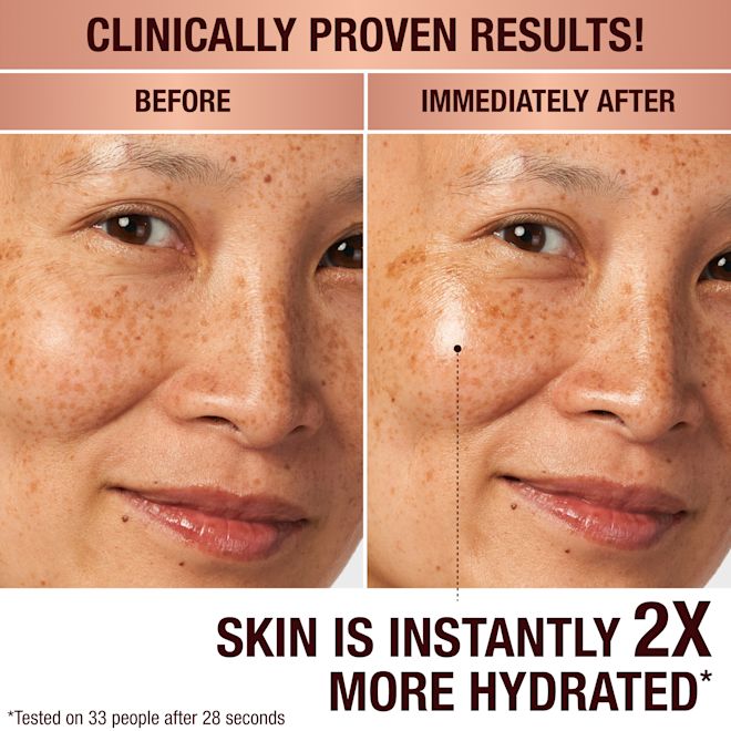 Charlotte's Magic Cream before and afters Charlotte's Magic Cream before and afters