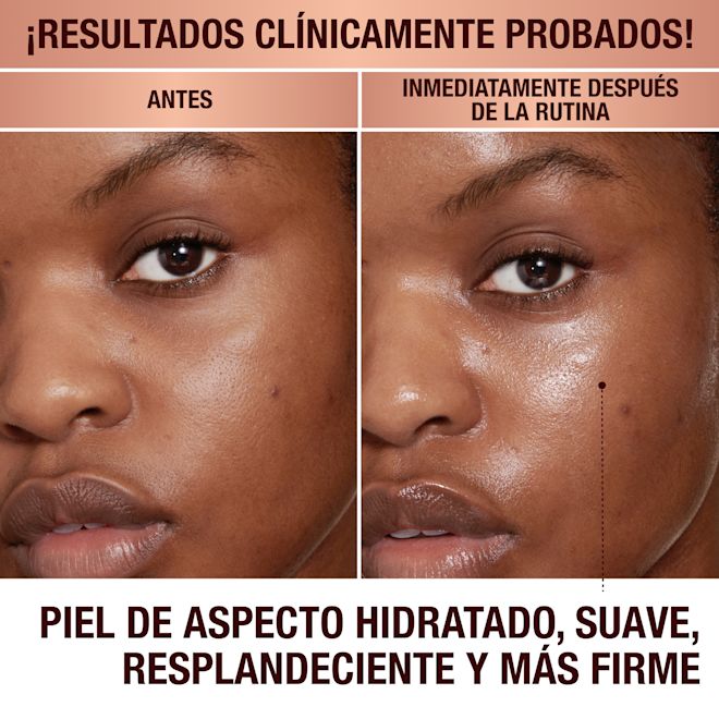 Antes y después de la Magic Cream Antes y después de la Magic Cream