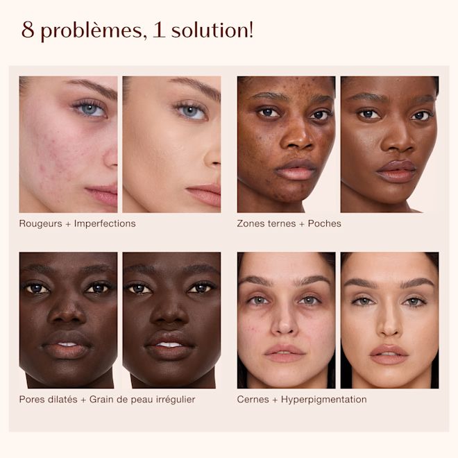Airbrush Flawless Concealer - Infographie 8 problèmes de peau, 1 solution Graphique intitulé « 8 problèmes, 1 solution! » montrant les étiquettes de texte pour les problèmes de peau: zones d'ombre et poches, pores et grain de peau, cernes et hyperpigmentation.