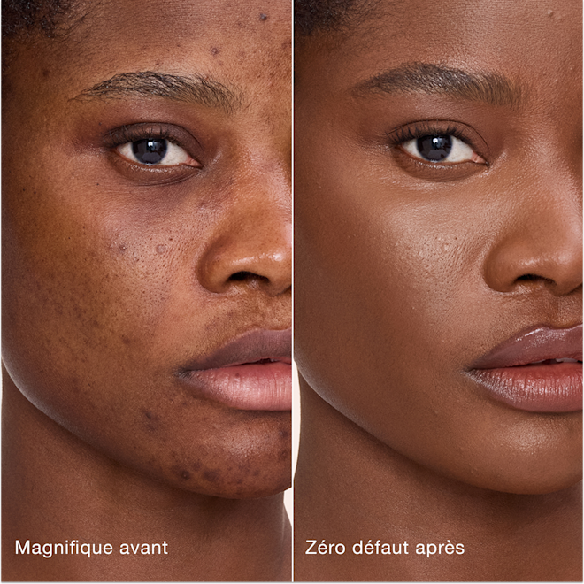 Avant/après Airbrush Flawless Concealer - 14 Deep (Foncé) Comparaison côte à côte de la peau avant et après l'application de l'Airbrush Flawless Concealer de Charlotte Tilbury, avec les étiquettes de texte « Magnifique avant » et « Zéro défaut après ».