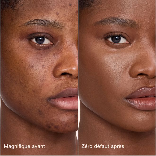 Avant/après Airbrush Flawless Concealer - 14 Deep (Foncé) Comparaison côte à côte de la peau avant et après l'application de l'Airbrush Flawless Concealer de Charlotte Tilbury, avec les étiquettes de texte « Magnifique avant » et « Zéro défaut après ».