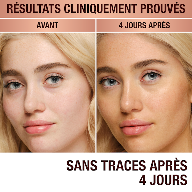 Beautiful Skin Island Glow Drops before and after 8 hours Clinically proven results! A fair blonde model with no tanning drops applied and the same model 8 hours after applying tanning drops with a bronzed glow.