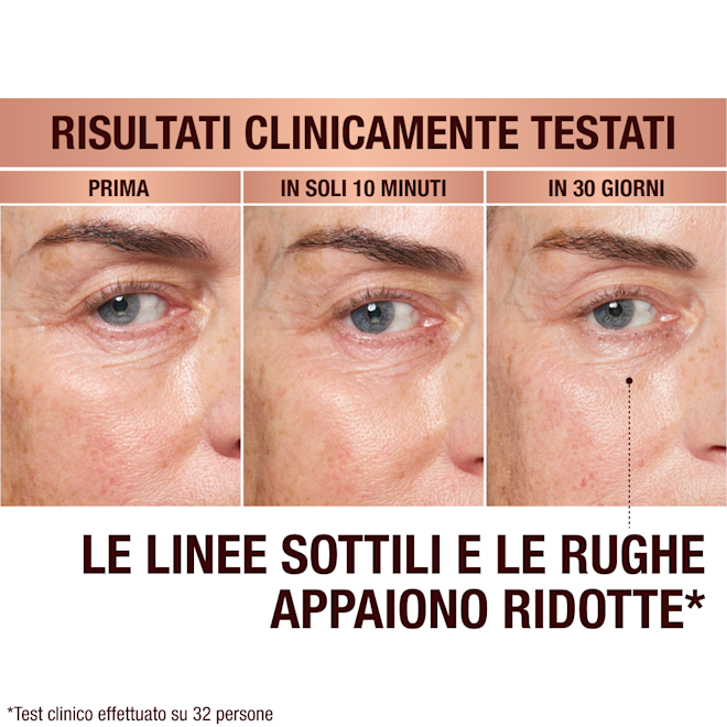 IT EyePatches-BA-3 Immediate Revival Patches - before and after