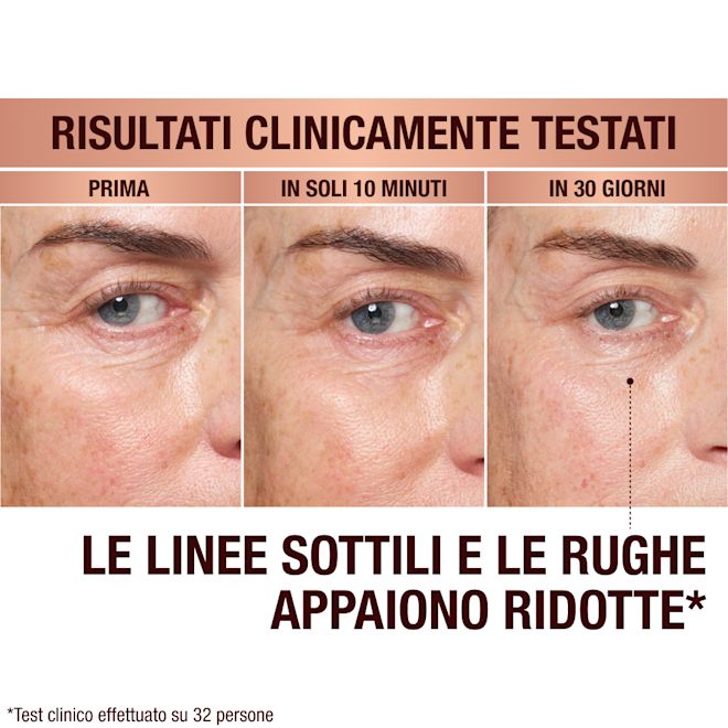 IT EyePatches-BA-3 Immediate Revival Patches - before and after