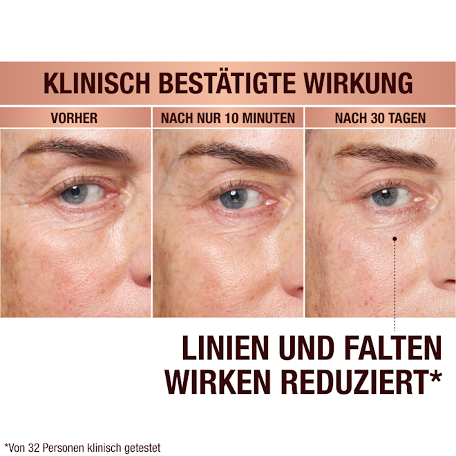 DE EyePatches-BA-3 (1) Immediate Revival Patches - before and after