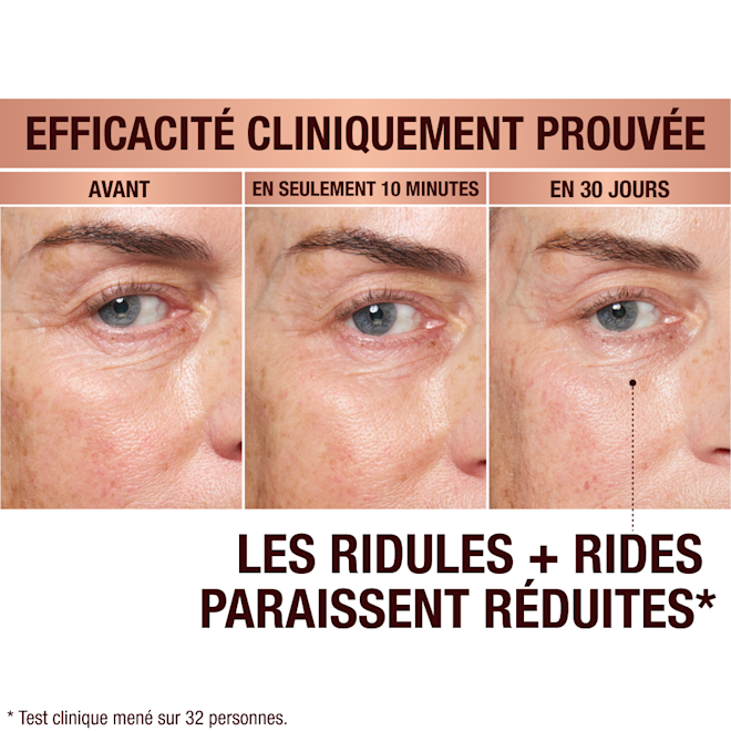 FRCA EyePatches-BA-3 Immediate Revival Patches - before and after