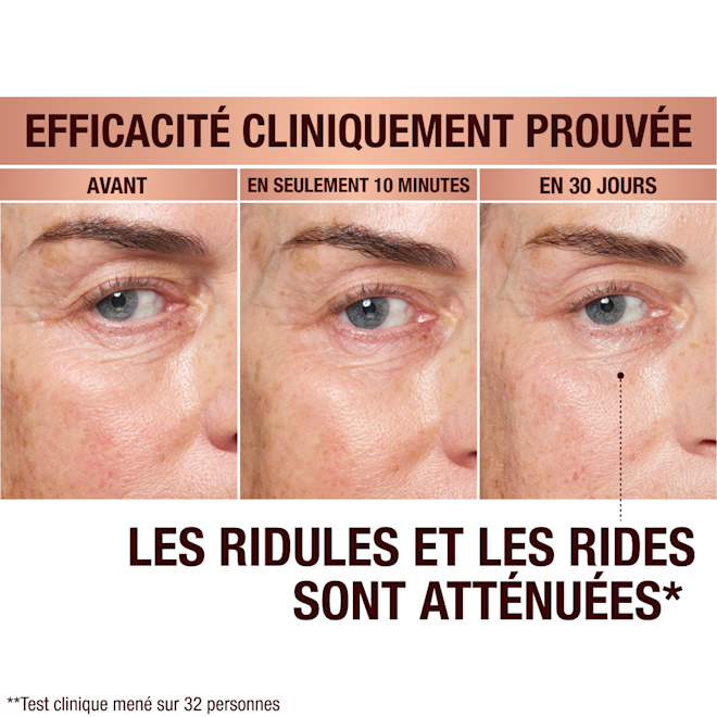 FR EyePatches-BA-3 Immediate Revival Patches - before and after