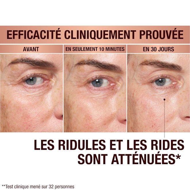 FR EyePatches-BA-3 Immediate Revival Patches - before and after