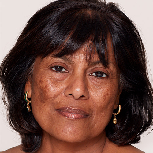 How to apply foundation for hyper-pigmentation How to apply foundation for hyper-pigmentation Charlotte Tilbury