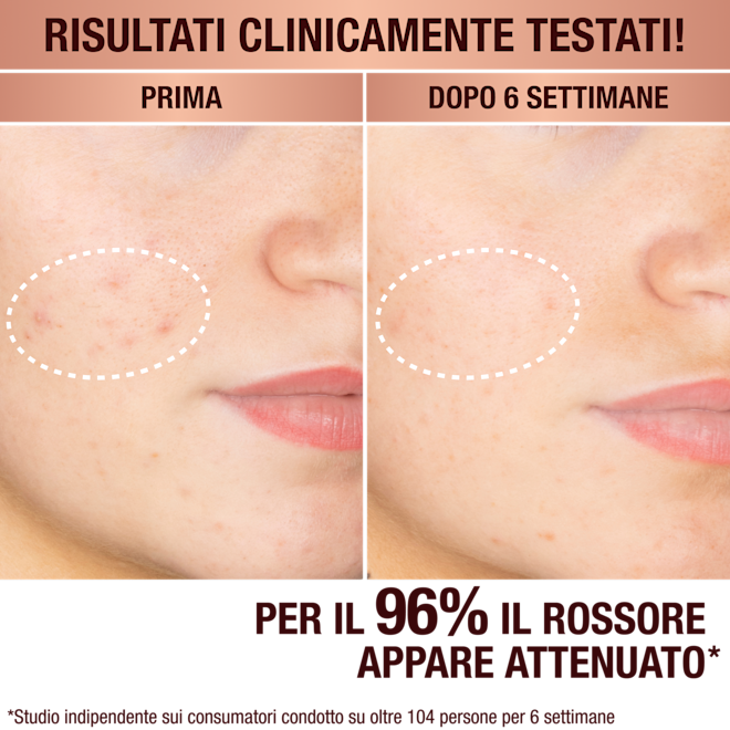 Il siero per macchie scure di Charlotte Il siero per macchie scure di Charlotte