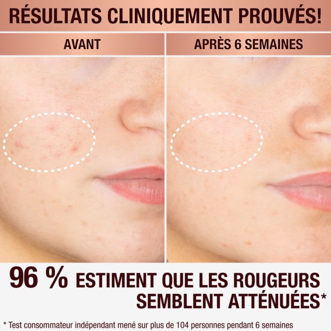 Sérum anti-taches brunes de Charlotte Sérum anti-taches brunes de Charlotte