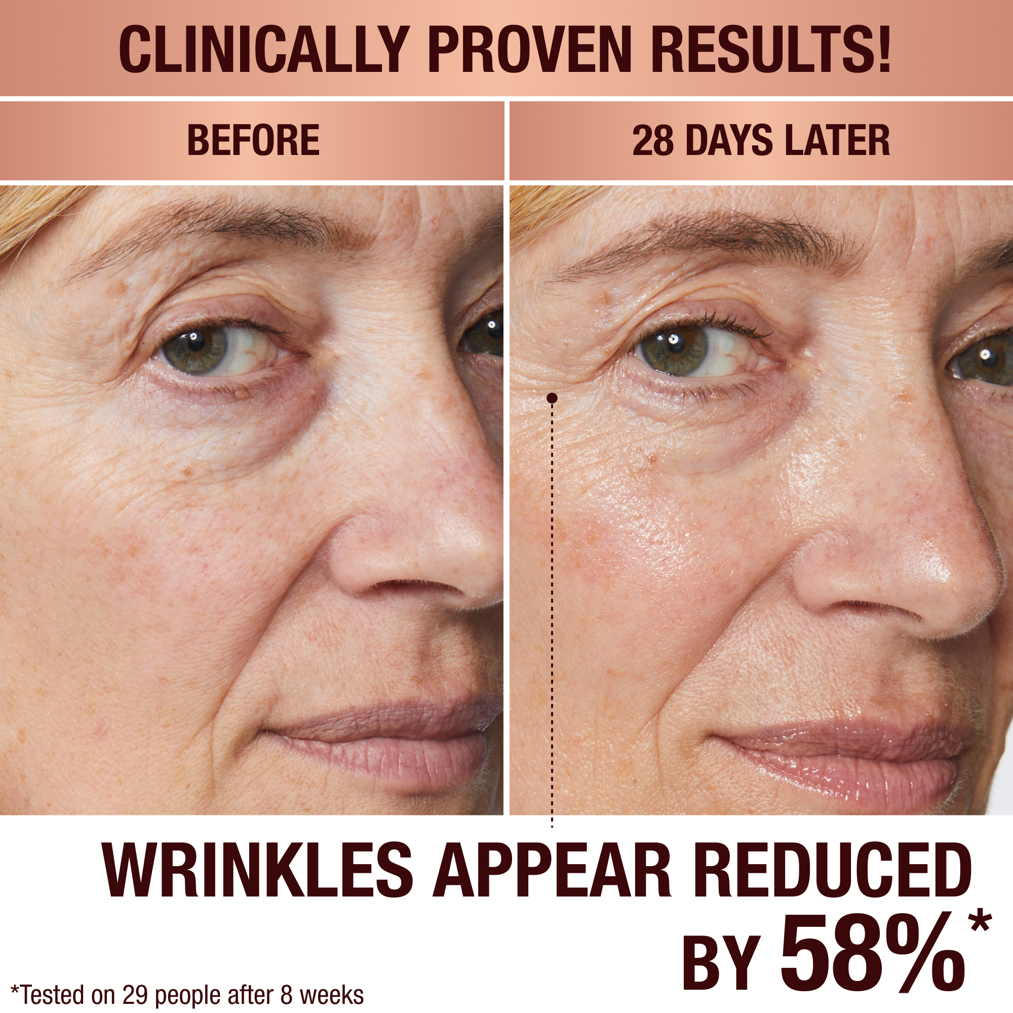 Anti-Ageing Skincare before and after
