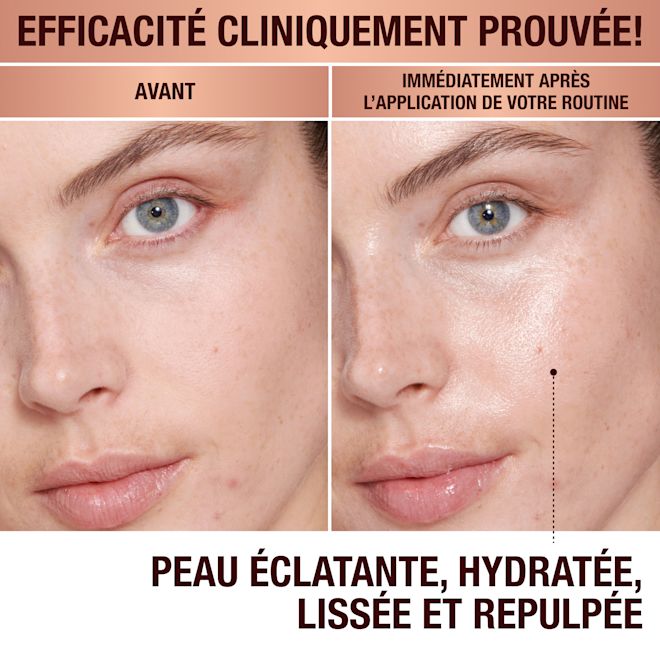 Magic Cream avant et après Magic Cream avant et après