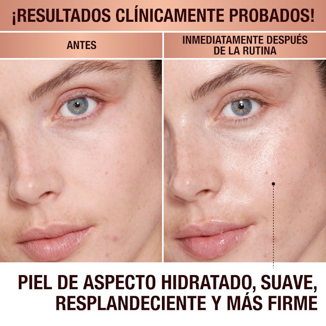 Antes y después de la Magic Cream Antes y después de la Magic Cream