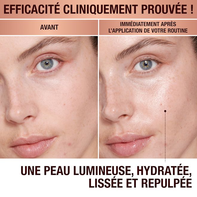 Magic Cream avant et après Magic Cream avant et après