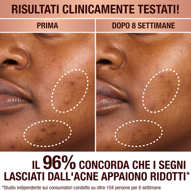 Il siero per macchie scure di Charlotte Il siero per macchie scure di Charlotte