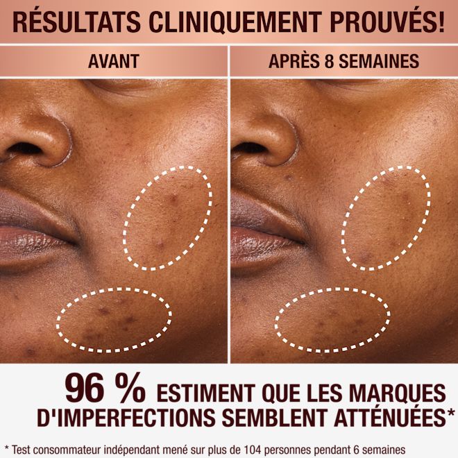 Sérum anti-taches brunes de Charlotte Sérum anti-taches brunes de Charlotte