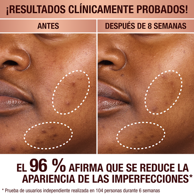 Charlotte's Dark Spot Serum Charlotte's Dark Spot Serum