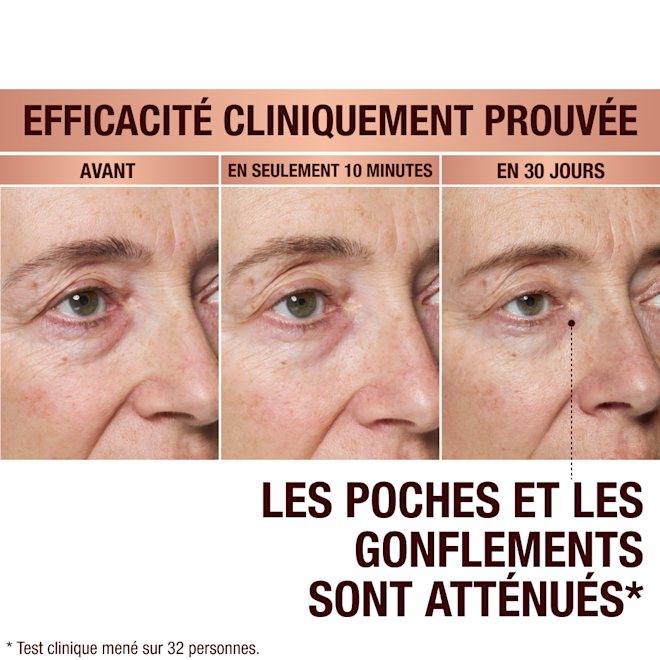 FRCA EyePatches-BA-1 Immediate Revival Patches - before and after
