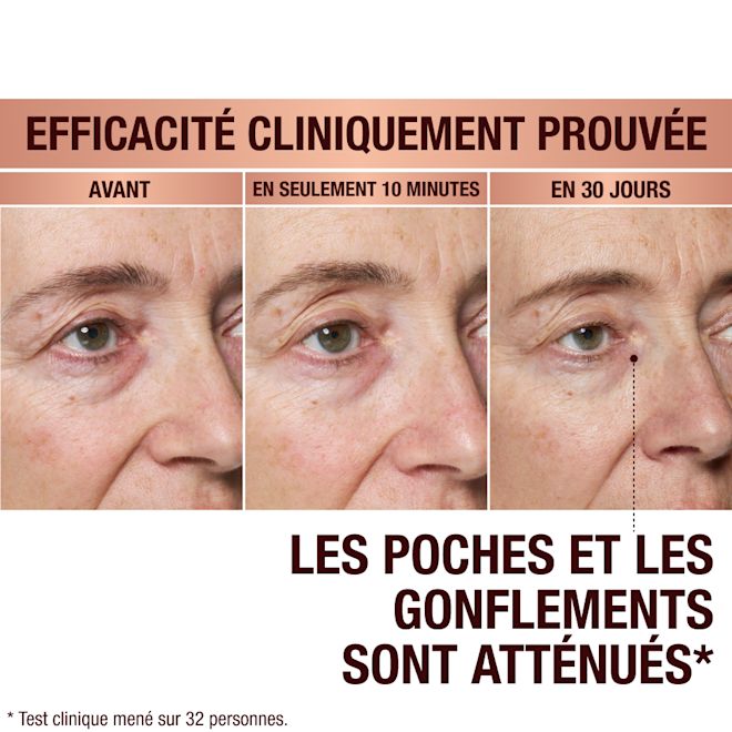 FRCA EyePatches-BA-1 Immediate Revival Patches - before and after
