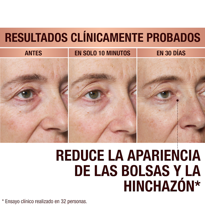 ES EyePatches-BA-1 Immediate Revival Patches - before and after