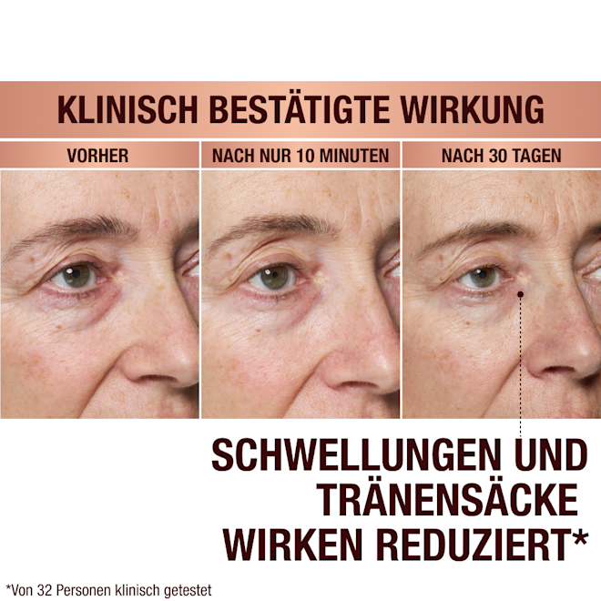 DE EyePatches-BA-1 (1) Immediate Revival Patches - before and after