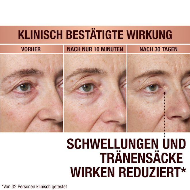 DE EyePatches-BA-1 (1) Immediate Revival Patches - before and after