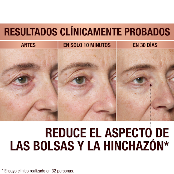 ESUS EyePatches-BA-1 Immediate Revival Patches - before and after