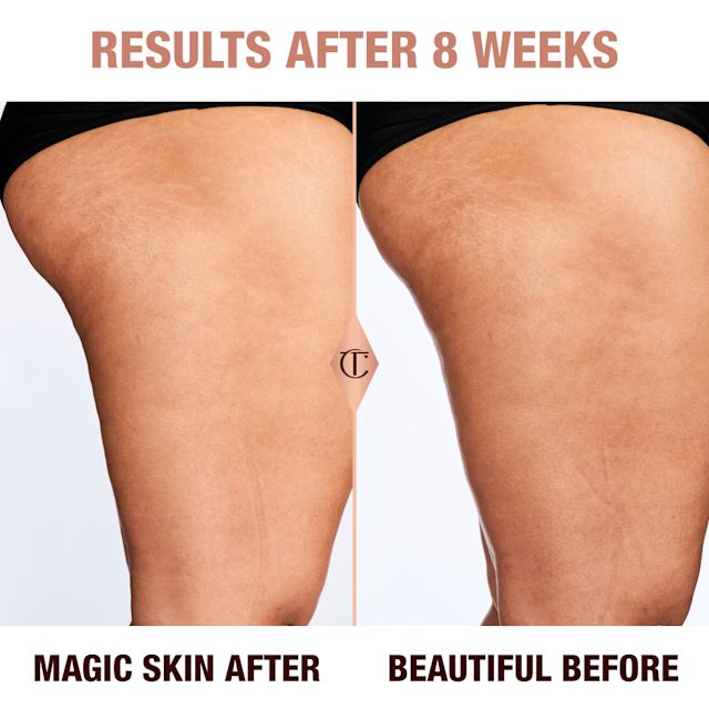 Magic Body Cream cellulite before and after Charlotte's Magic Body Cream results in 8 weeks reducing the appearance of cellulite