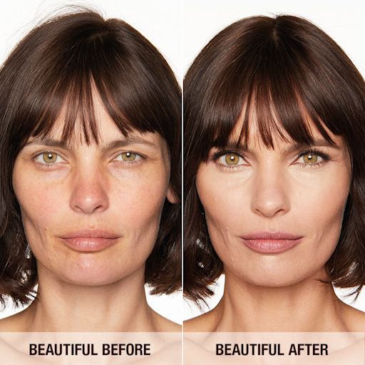 magicfoundation2018_beforeafter_5 magicfoundation2018_beforeafter_5